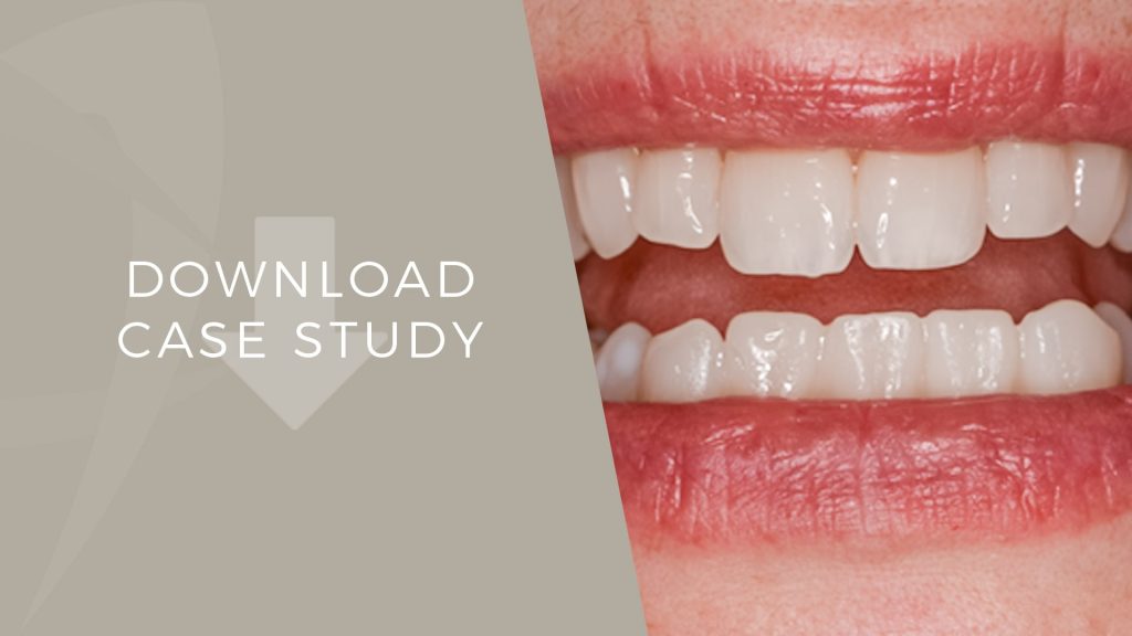 Orthodontics London Dental Specialists