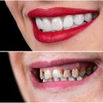 Top 5 Cosmetic Dentistry Treatments min scaled 1