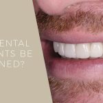 can dental implants be whitened