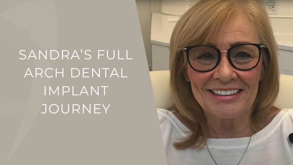 Sandra's Full Arch Dental Implant Journey