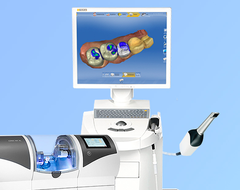 Example image of Computer Aided Design and Computer Aided Manufacturing (CAD/CAM) Dental Technology at London Dental Specialists in London, UK