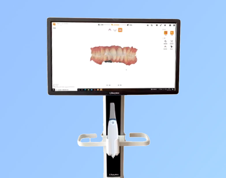 An image of a Digital Intraoral Scanner at London Dental Specialists: A Dental Clinic in London, UK. Image being used as an example for how it is used in Dental Implants Dental Treatments