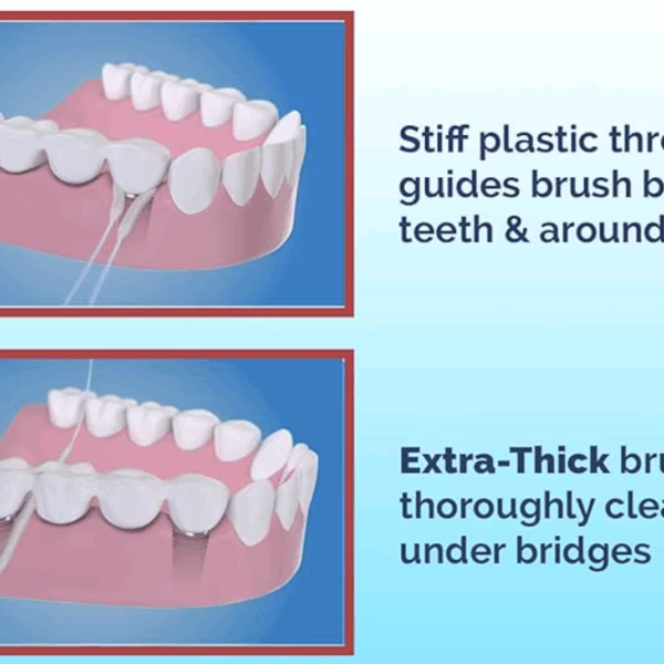 Proxy floss for dental implants and braces