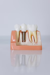 Can a Dental Infection Spread to Adjacent Teeth?