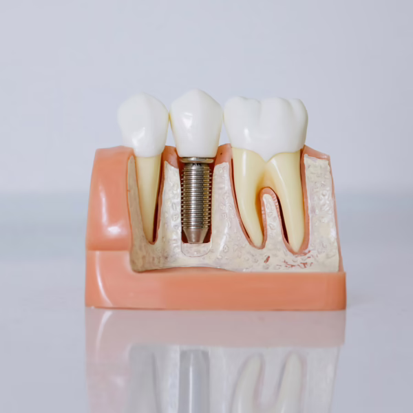 Dental infection treatment in london uk