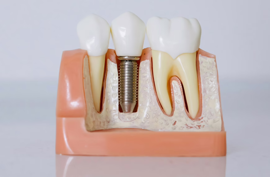 Dental infection treatment in london uk