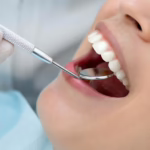 Tooth extraction in london uk