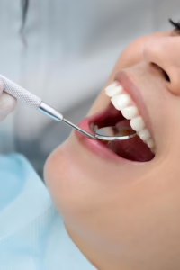 What Is Dry Socket After Tooth Extraction?