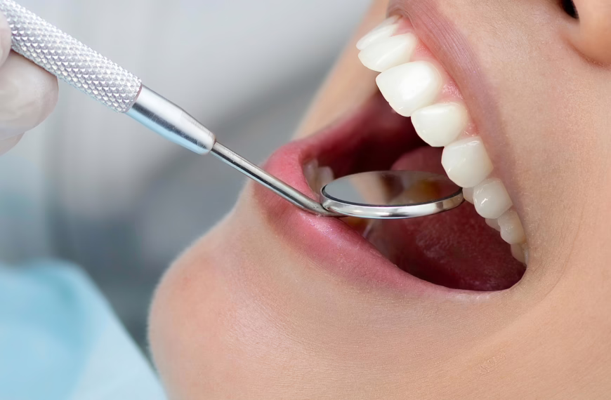 Tooth extraction in london uk