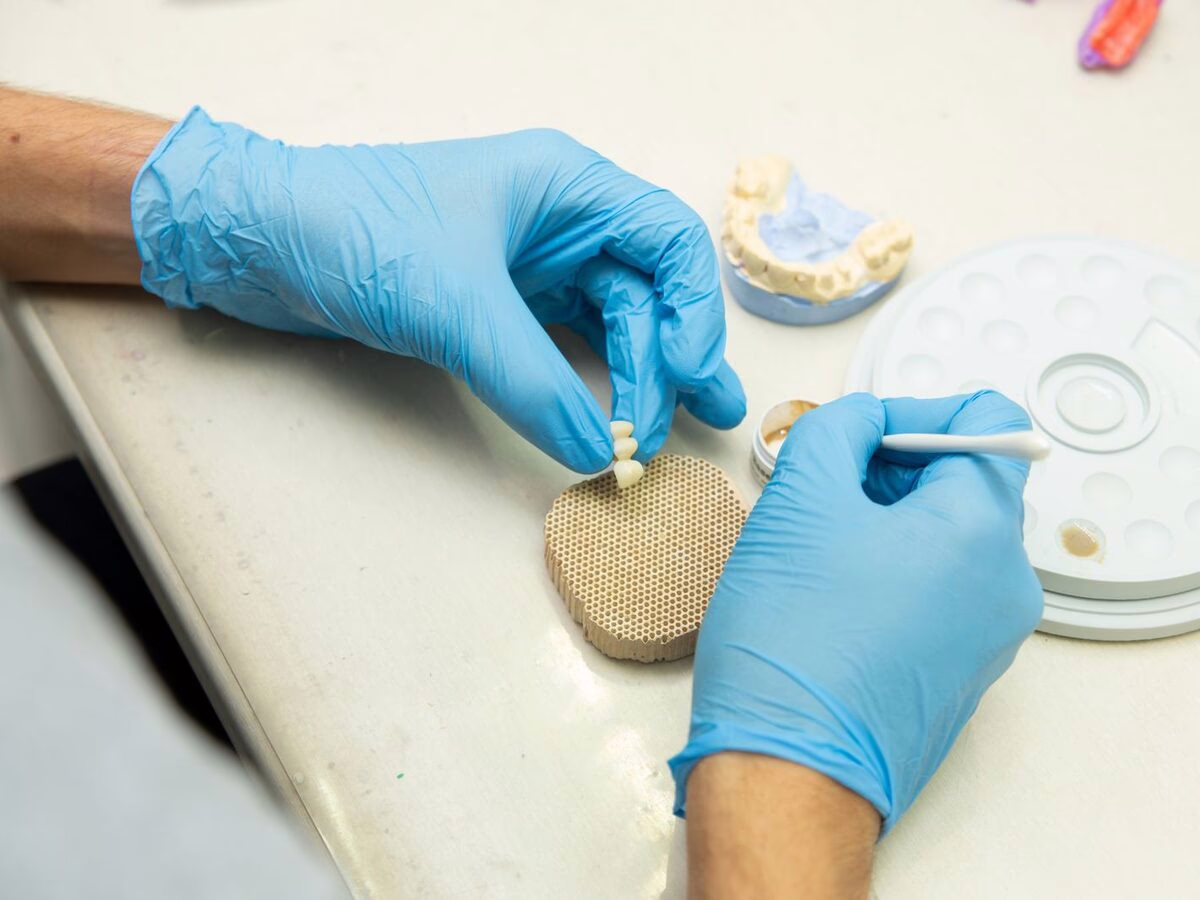 A dental technician placing a crown in the laboratory