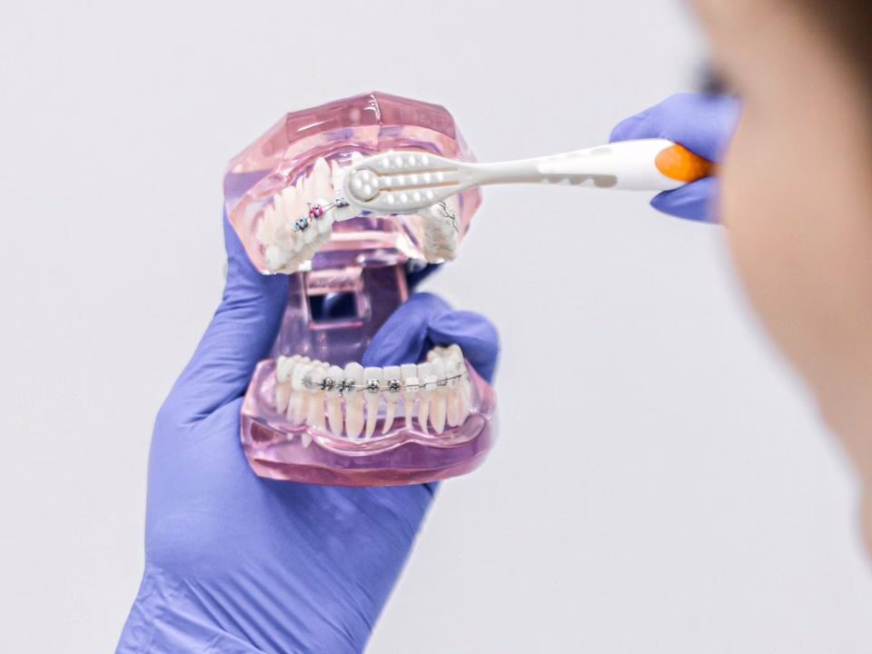 Brushing technique demonstrated on a model for a patient