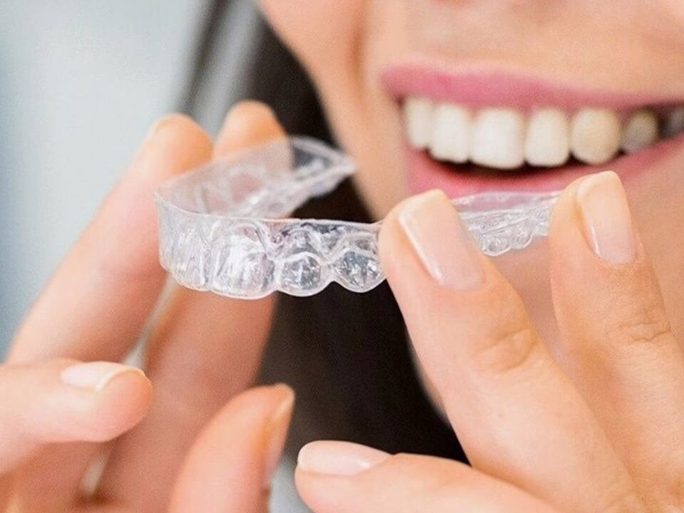 A woman inserting a clear aligner