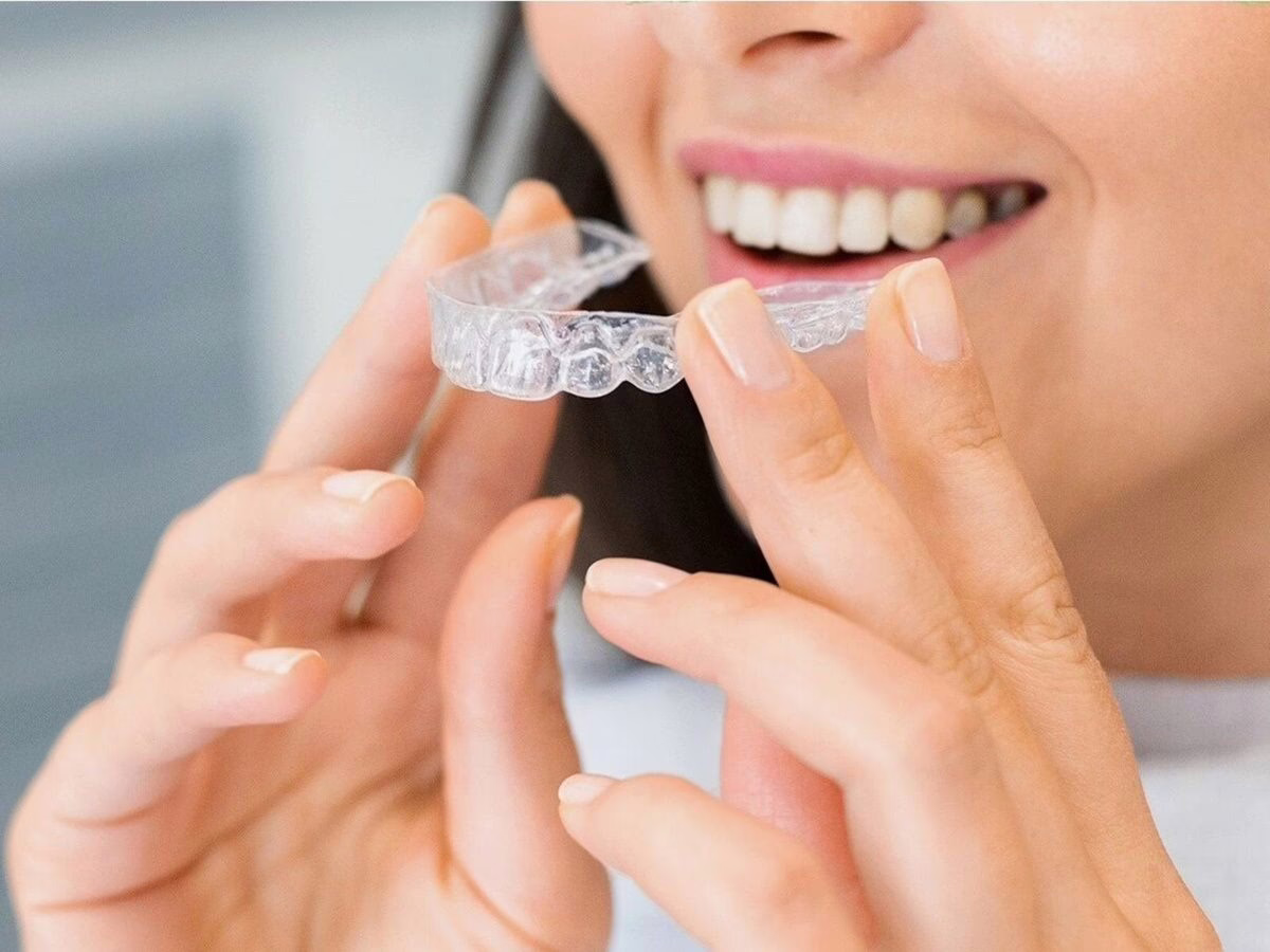 A woman inserting a clear aligner