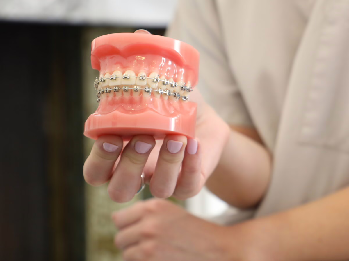 Dental model with fixed braces