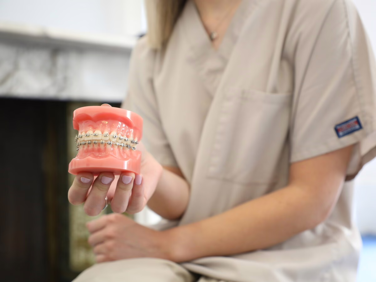 Dental model with fixed braces