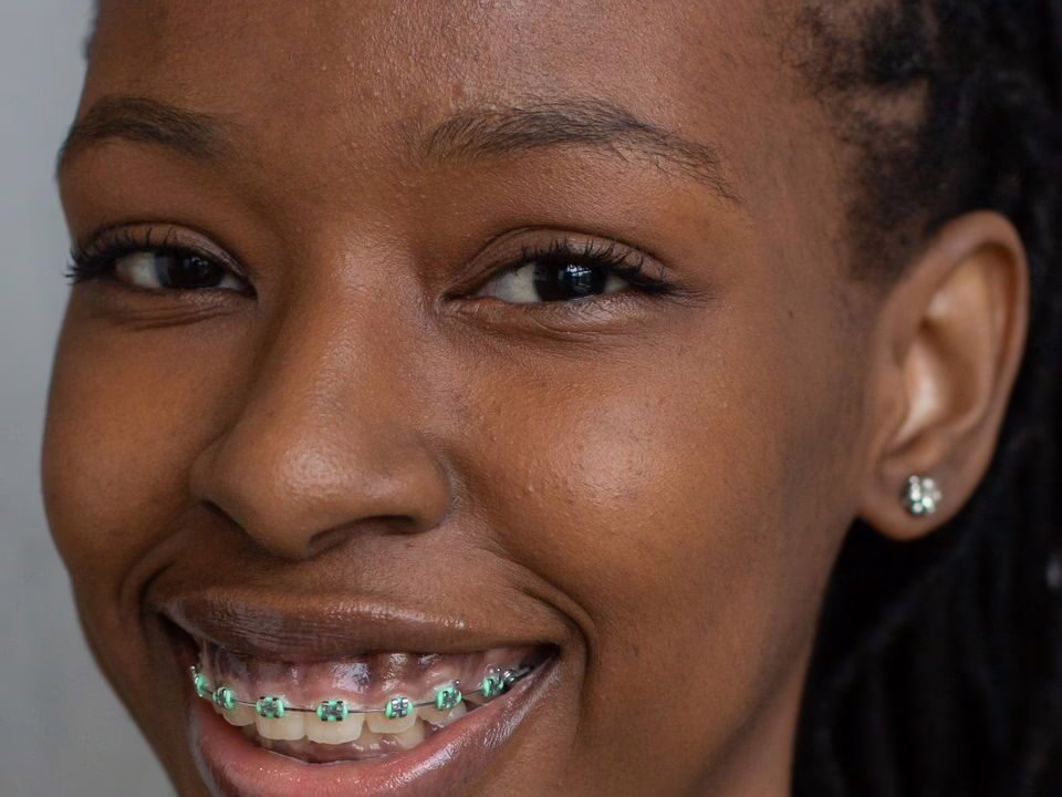 A smiling woman wearing braces