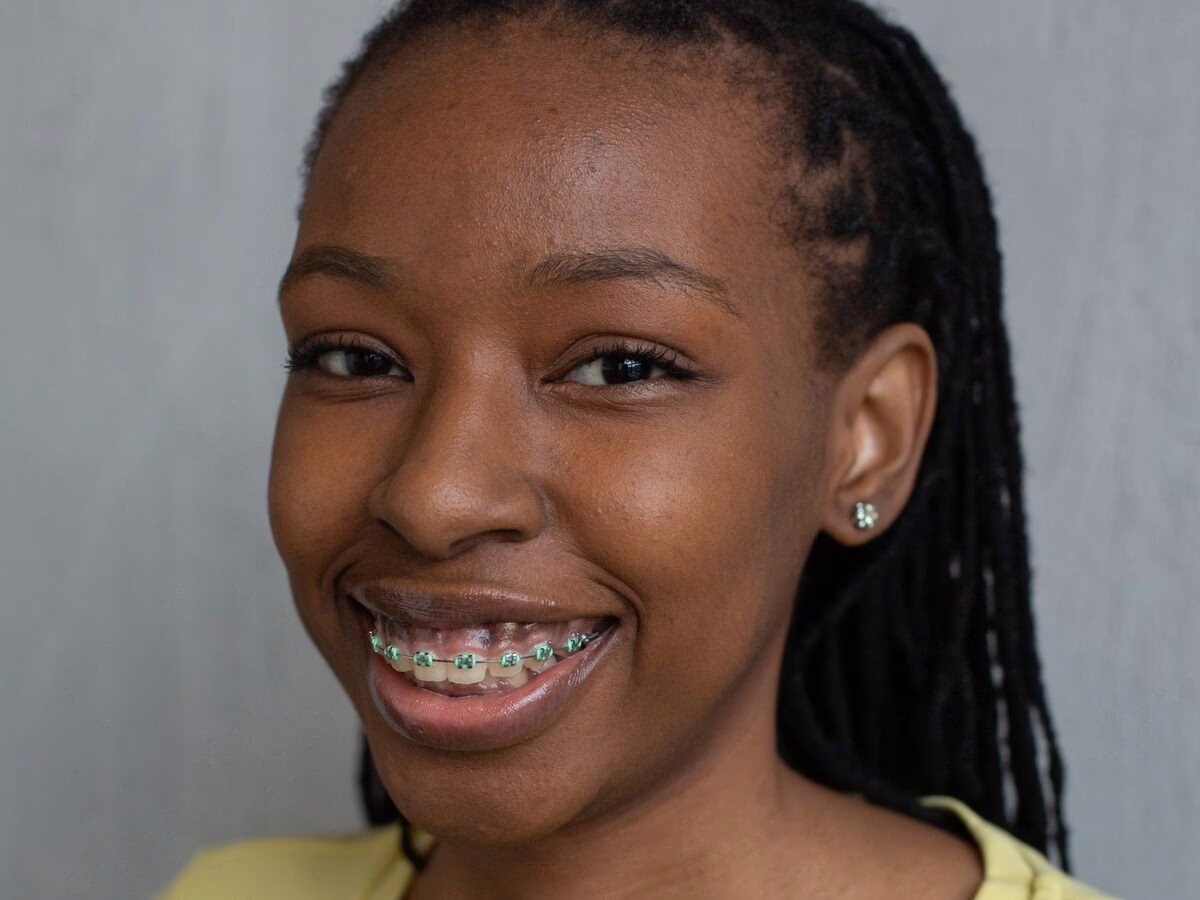 A smiling woman wearing braces