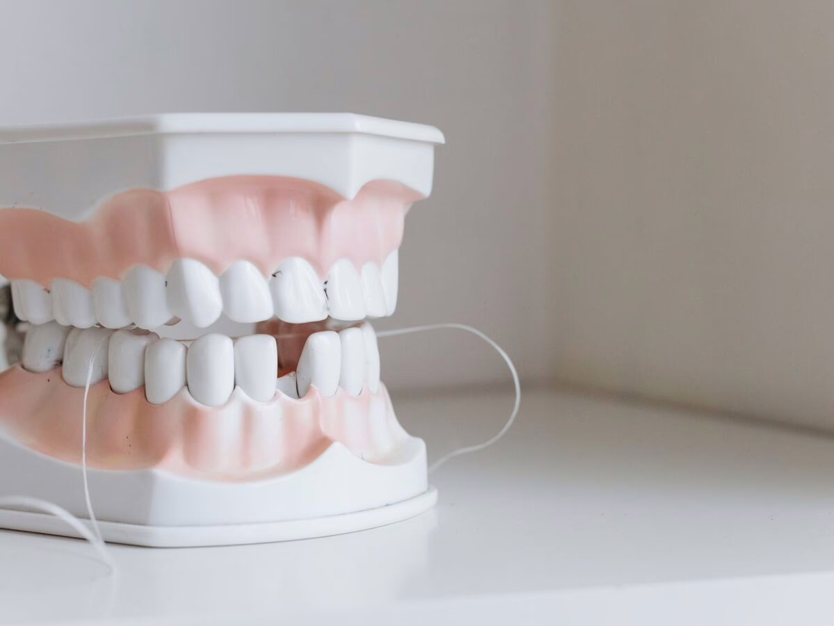 A dental model with braces and floss