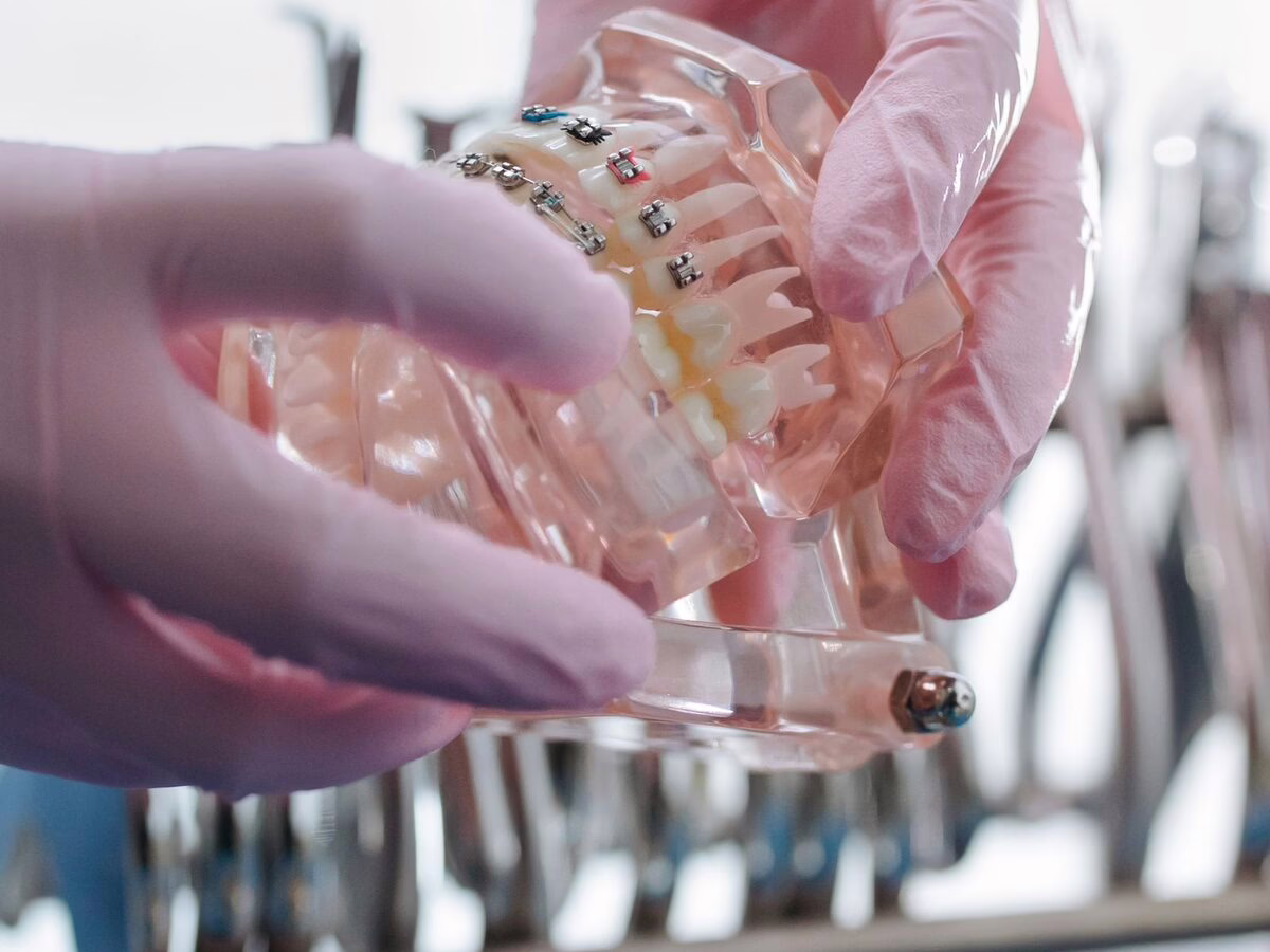 Gloved hands holding a model with clear braces