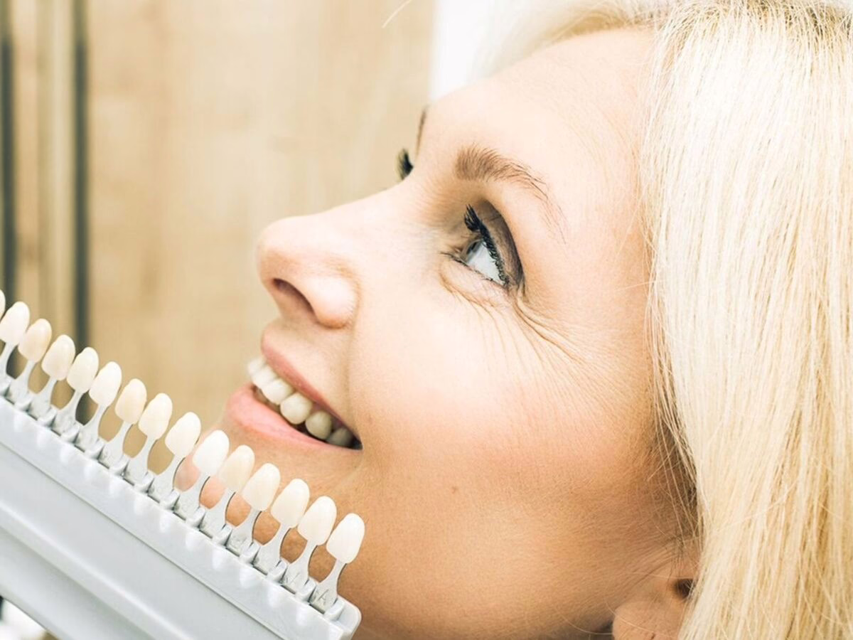A smiling patient having their tooth shade matched