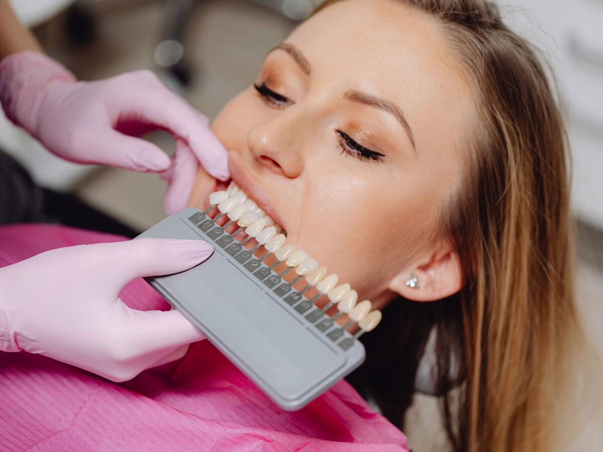 A tooth shade guide held against a patient's teeth