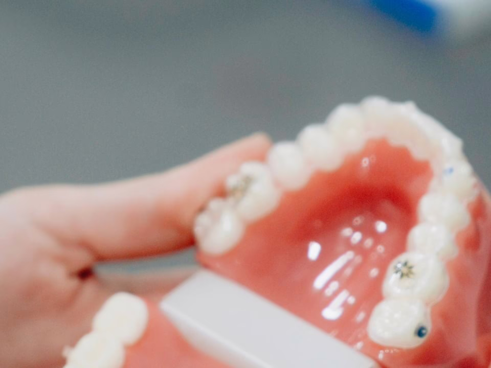 An orthodontic retainer on a dental model