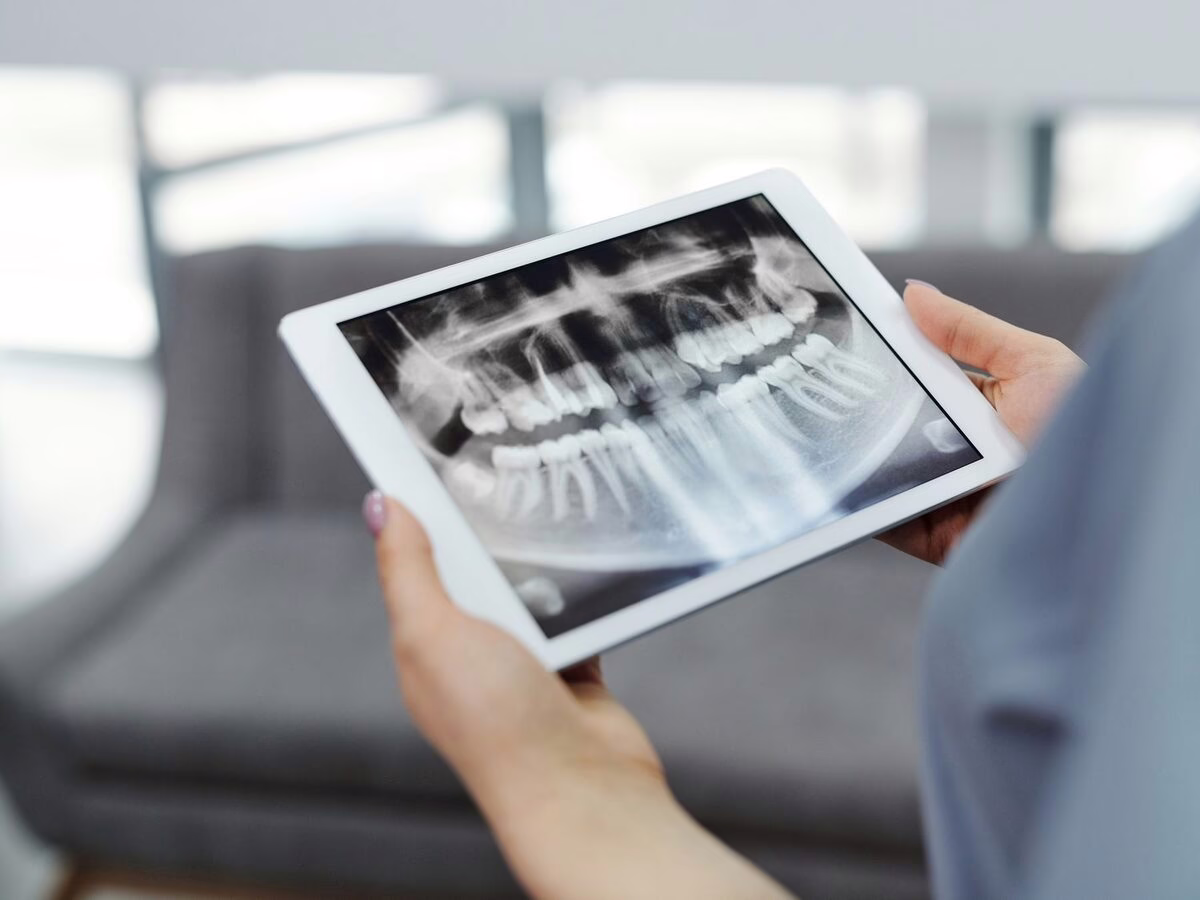 A panoramic dental x-ray on a tablet