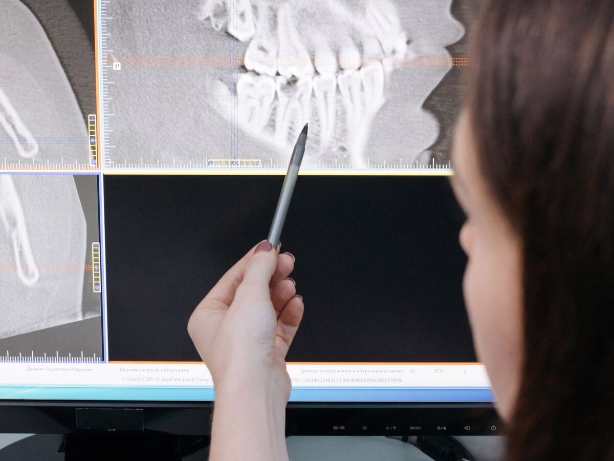 A dental scan being annotated on screen