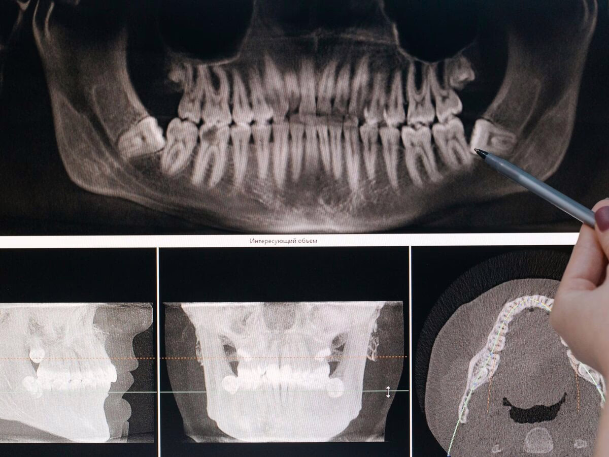 A panoramic x-ray and CT slices reviewed on screen