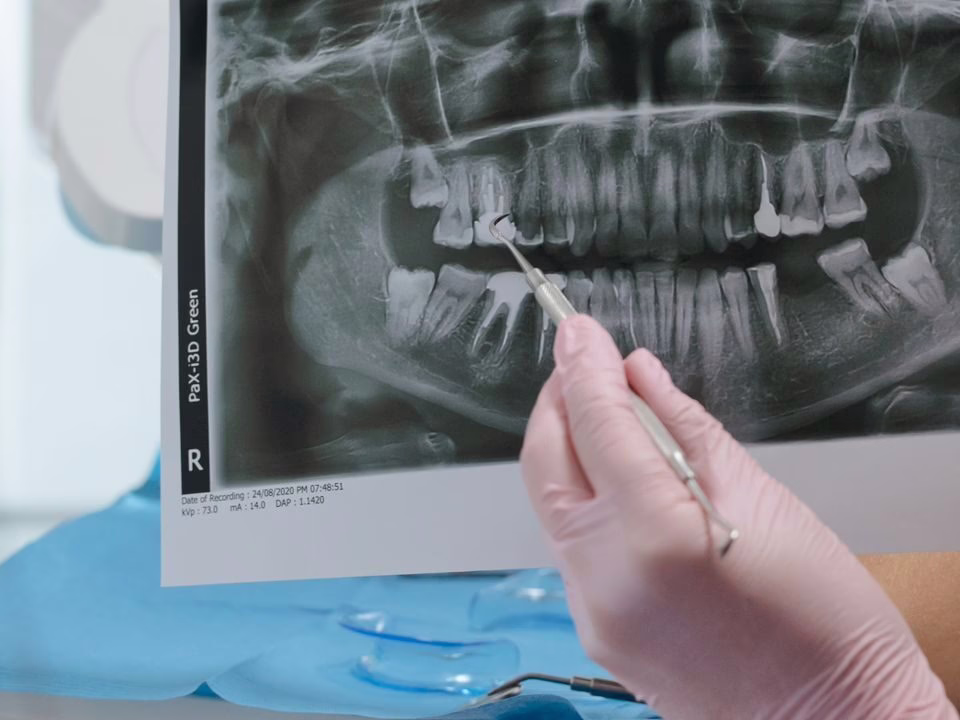 A panoramic x-ray reviewed on screen