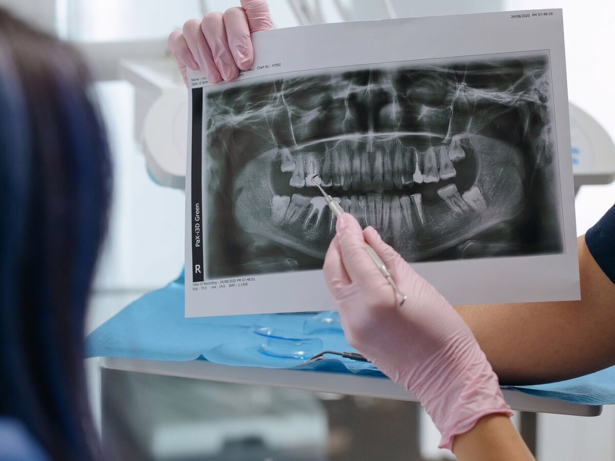 A panoramic x-ray reviewed on screen